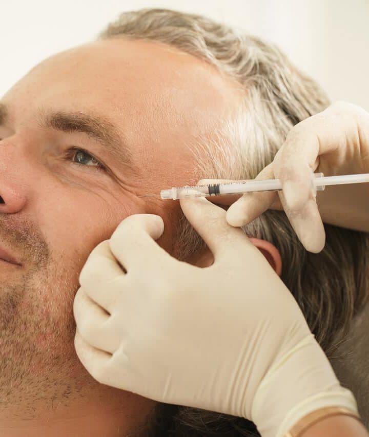 Botox-KraehenfuesseMann