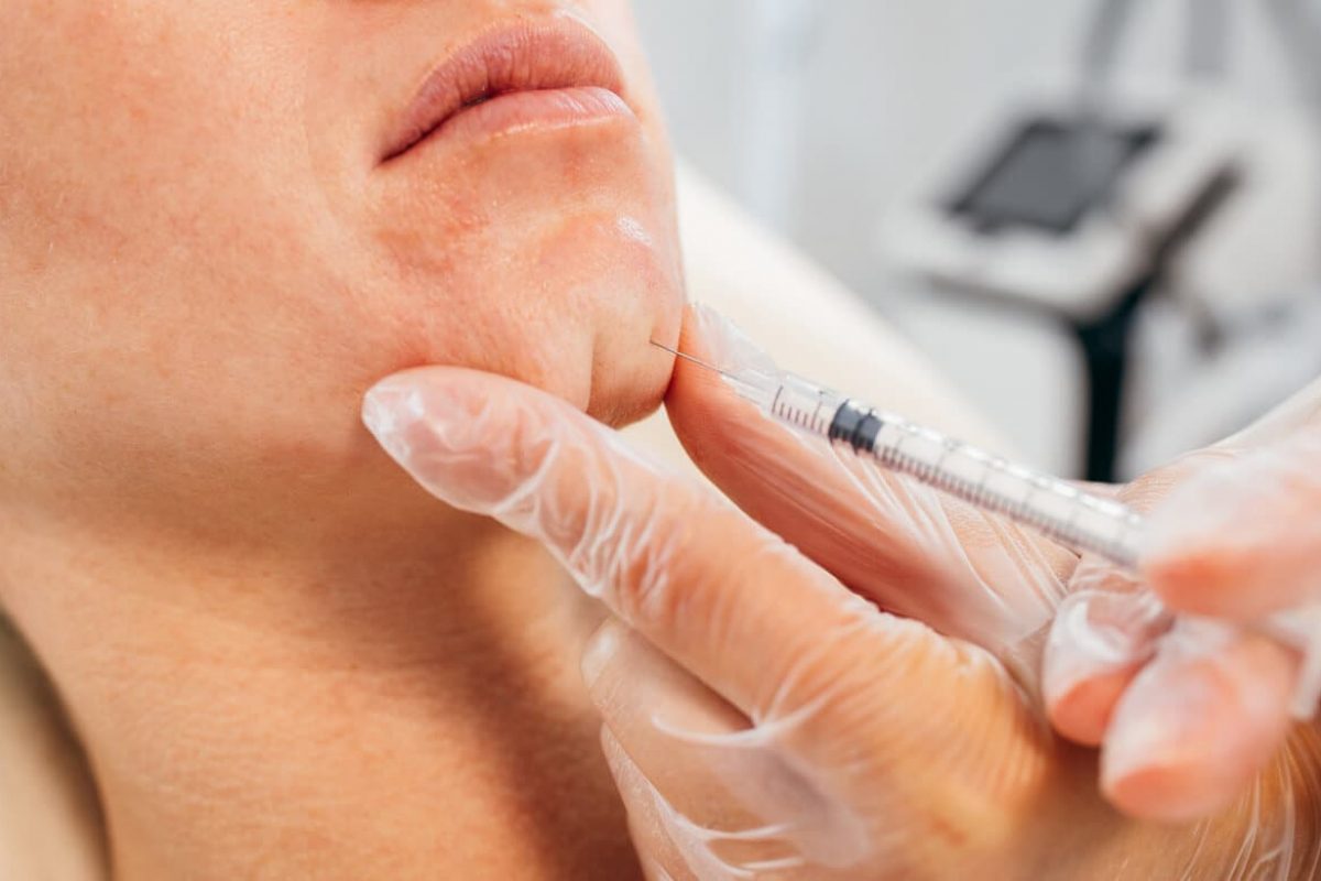 Botox-Pflastersteinkinn