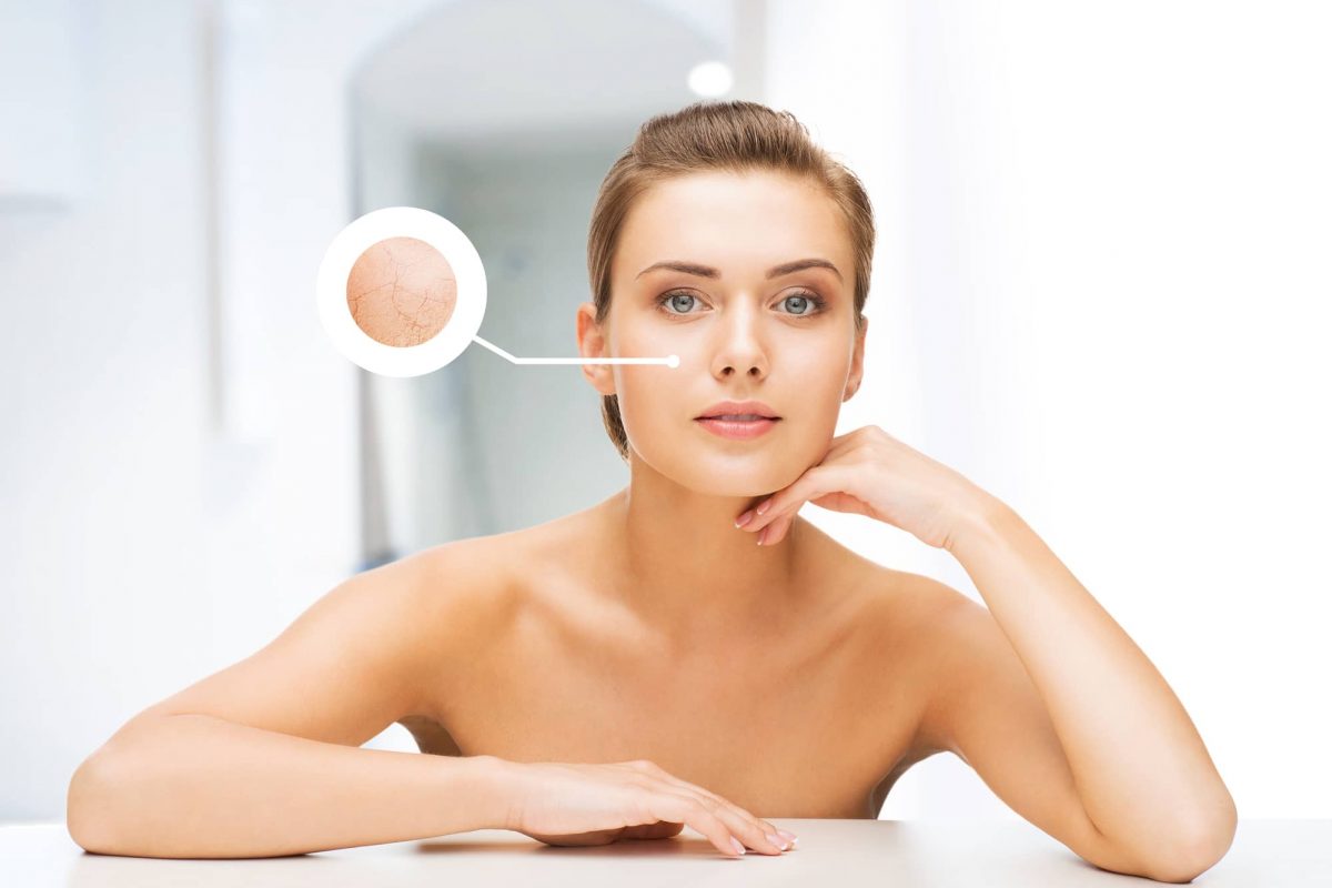 beauty and skin care concept - face of beautiful woman with dry skin examples